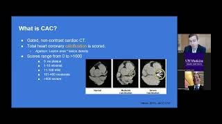 Cardiac CT and Plaque Assessment: More than a diagnosis. screenshot 4