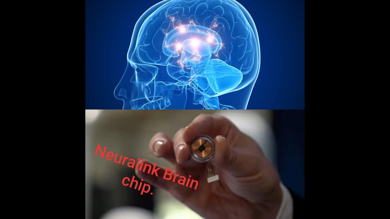 FUTURE IS NOW NEURALINK - THE BRAIN CHIP🤔😮😮 - YouTube