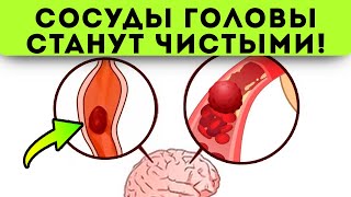 Смотрите, что делают старые врачи для чистки сосудов головы! Сосуды головы чистят...