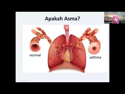 WEBINAR PROGRAM MEMASYARAKATKAN KESIHATAN RAKYAT SIRI 9/2020: "ASTHMA: APA ANDA PERLU TAHU"