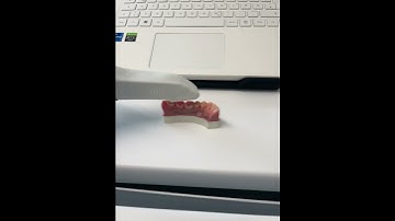 iTero ELEMENT 5D Laptop