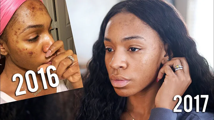 HOW I CLEARED MY SKIN! Skincare Routine + Fav Prod...