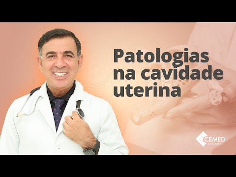 Vídeo: Quem é a cavidade uterina?