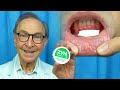 Zyn  oral health risks and benefits reviewed by dr nemeth