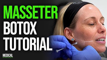 Masseter Botox for Facial Slimming and Migraines | Full Procedure Demonstration