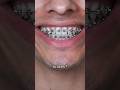 WATCH Before Brushing Your Braces #braces