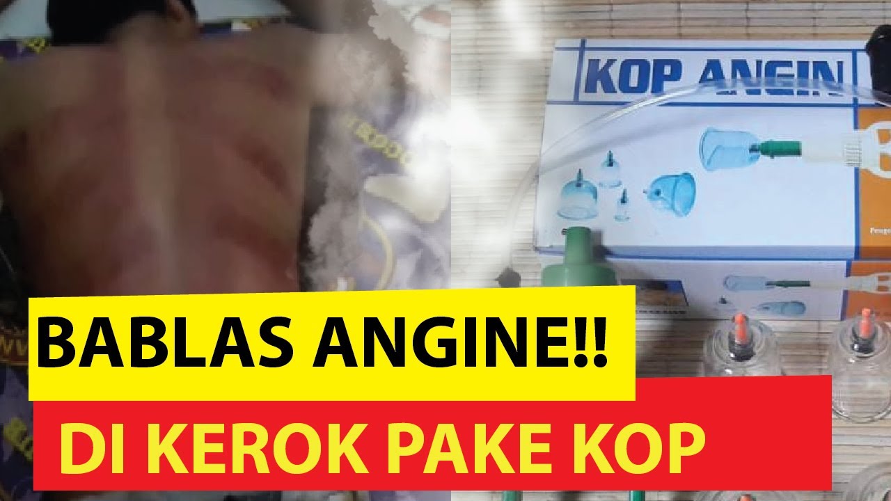 Cara Kerokan Saat Masuk Angin Punggung & Badan | Manfaat Alat Kop #