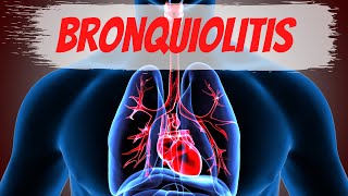 Bronquiolitis en el Adulto Bronquiolitis en el Adulto