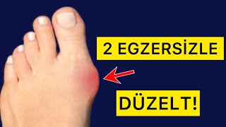 AYAK BAŞ PARMAK ÇIKINTISINI 2 EGZERSİZLE DÜZELT! #halluksvalgus #fizyoterapistmacide