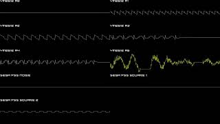 Sonic 3D Blast Genmd - Unused Boss Theme 819 Version - In Oscilloscope View