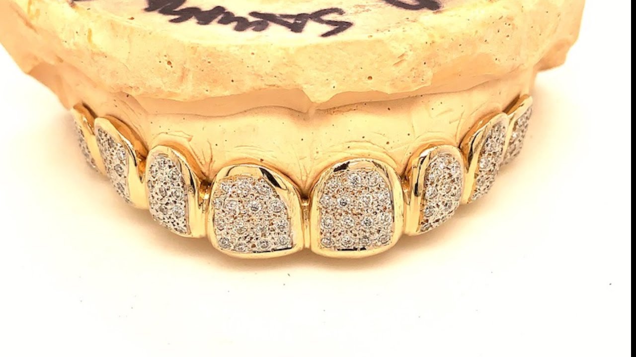8pc Solid Gold Vvs Diamond Flooded Top Grillz By Seattle Gold Grills