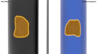 Werking Ionenwisselaar Minimax Waterverzachters