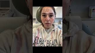 Bells Palsy At 33 My Pregnancy Journey & Recovery With Botox