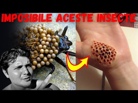 Video: Cele mai rapide insecte din lume