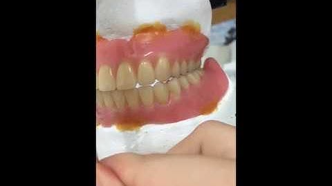 Complete denture working balancing