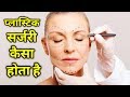 प्लास्टिक सर्जरी कैसे होता है ।। Plastic Surgery Kaise Hota Hai ?