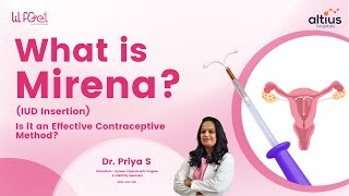 What Mirena (IUD Insertion)? Is it an Effective Contraceptive Method?