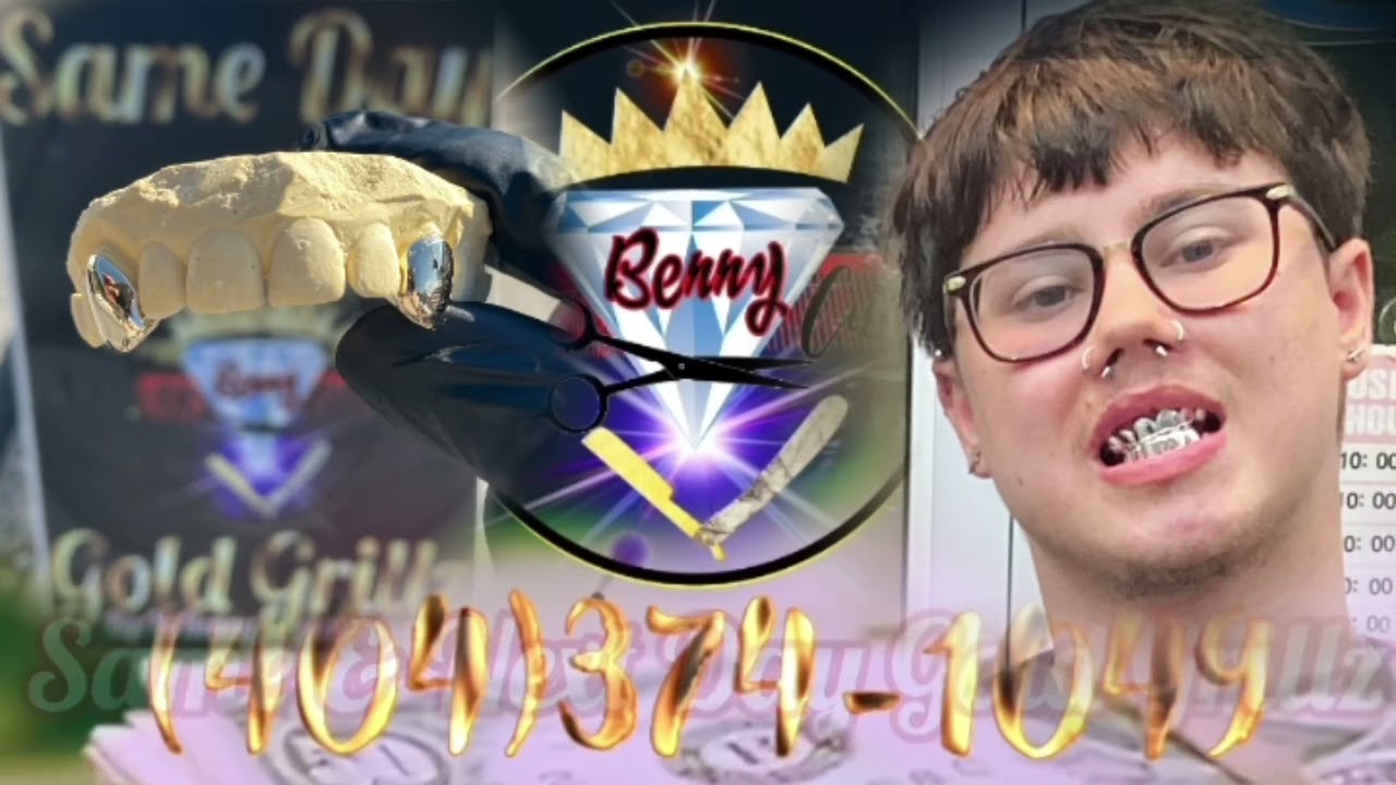 Atlanta Gold Grillz Same Day Tight & Right! YouTube