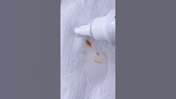 Quick & Easy Stain Remover for Clothes - Say Goodbye to Stubborn Stains!