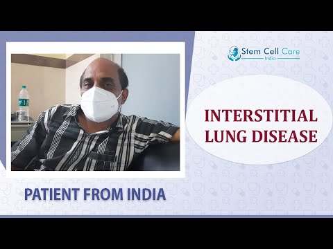 Patient husband shares his experience after stem cell therapy for Chronic Kidney Disease & ILD