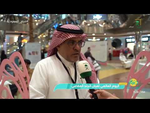 في اليوم العالمي لمرض الجلد الفقاعي جمعية الفراشة تطلق أنشطتها المجتمعية في التوعية بالمرض