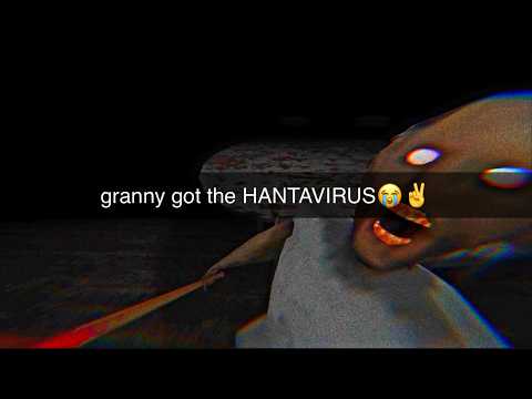 granny genuinely gave me straight dentures in hollow mode😭🥀