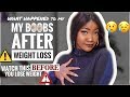 THIS HAPPENED TO MY BREASTS/BOOBS AFTER I LOST WEIGHT | WEIGHT LOSS Q&A | DEALING WITH STRETCH MARKS