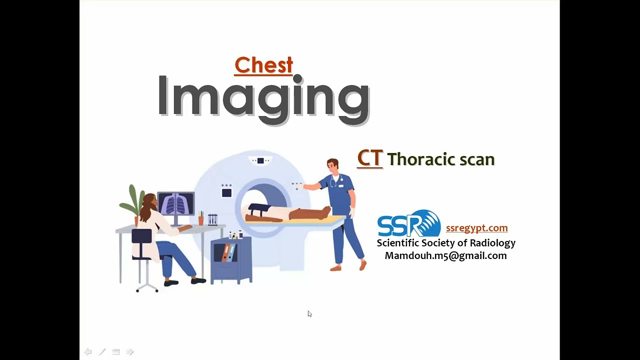 2 CT thoracic scan TEC Prof Mamdouh Mahfouz