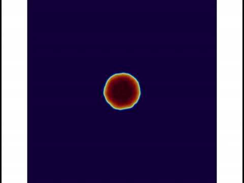 Tumor growth by lattice Boltzmann method
