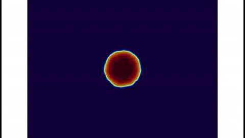 Tumor growth by lattice Boltzmann method