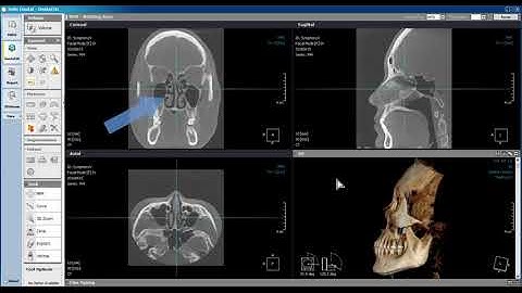 Xelis Dental Load ProjectFile
