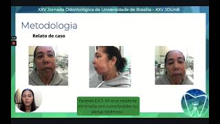 ( 501531) Celulite Facial de Origem Odontogênica: Relato de Caso