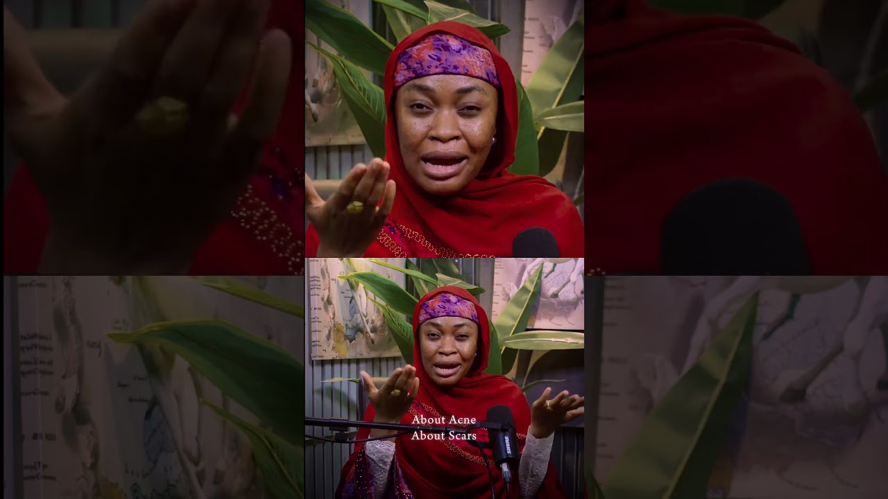 Confidence -Acne. Scars don’t define us—strength does! 💪 