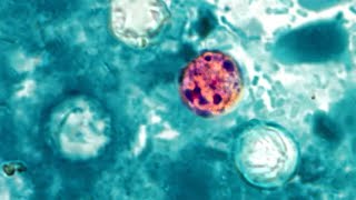 How Trump admin cuts have compromised food safety