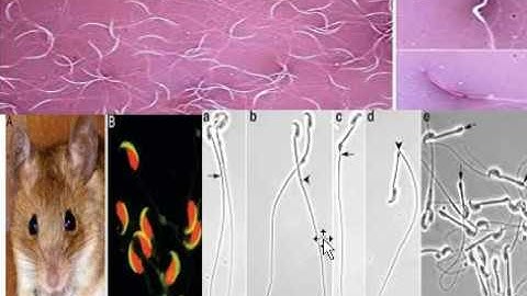Semen Analysis(Part 3) #SpermatozoaExamination #Sperm #ChristmasTreeStain #ForensicSerology #UGCNET