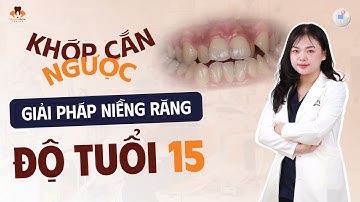 15 Tuổi – Cắn Ngược, Hàm Dưới Đẩy Ra Trước: Cách Khắc Phục Tại Nha Khoa Dr Hưng - Gia Lâm