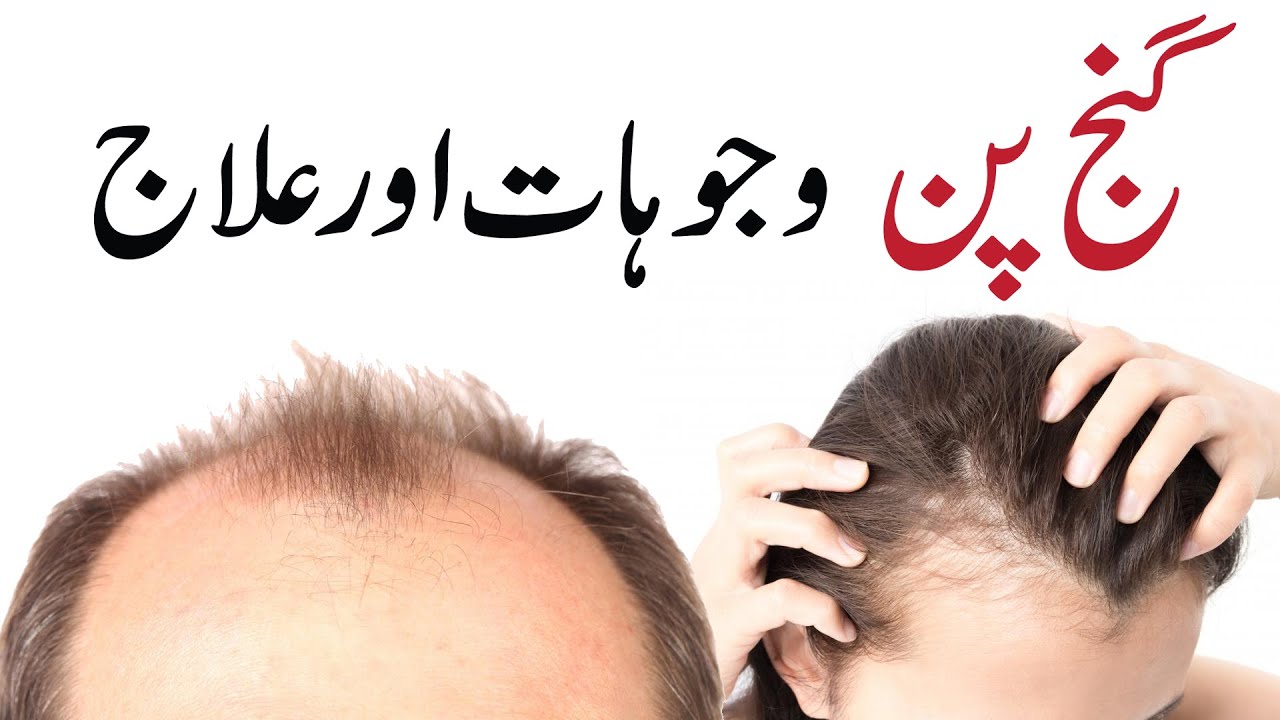 Hair Fall Reason And Treatment YouTube Hair Fall Reason And Treatment YouTube