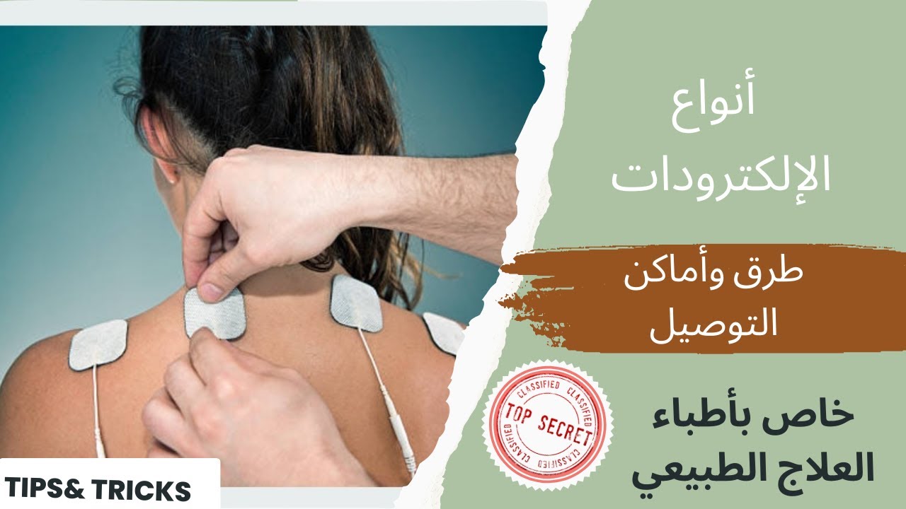 methods of electrode placement(Electrotherapy) YouTube