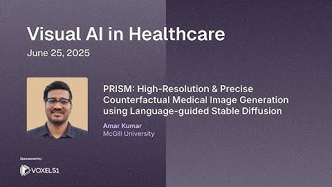 PRISM: High-Resolution & Precise Counterfactual Medical Image Generation using Language-guided S D