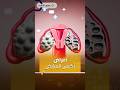 أعراض قد تدل على الإصابة بـ تكيس المبايض احذري منها صحة احذري