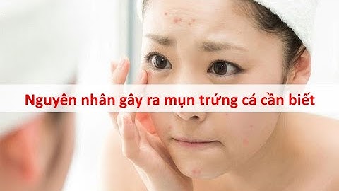 Nguyên nhân gây ra mụn trứng cá cần biết