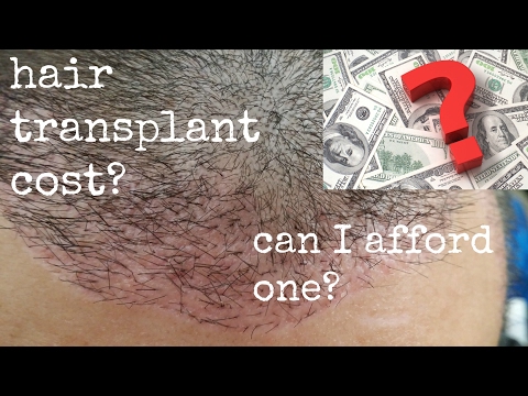 how-to-afford-a-hair-transplant-/-hair-transplant-cost-/-hair-loss-treatment