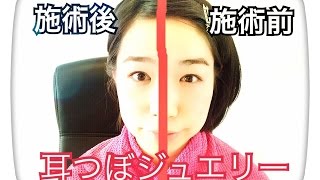 顔の輪郭が激変！？中井の耳つぼジュエリーサロンAiry（エアリー）