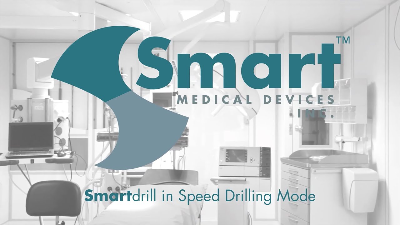 SMD Smartdrill Speed Drilling - YouTube