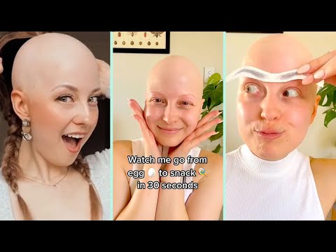 The Truth Behind My Looks ✨ My Journey With Alopecia And Realistic Wig Tutorial | Tyla