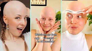 The Truth Behind My Looks ✨ My Journey With Alopecia And Realistic Wig Tutorial | Tyla