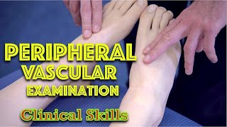 Peripheral Vascular Examination  Clinical Skills  Dr Gill