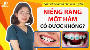 MUỐN NIỀNG RĂNG 1 HÀM CÓ ĐƯỢC KHÔNG? Yếu tố nào quyết định Niềng răng được 1 hàm?