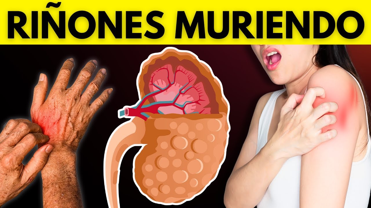 7 SEÑALES PELIGROSAS en tu CUERPO de que TUS RIÑONES están SUPLICANDO AYUDA