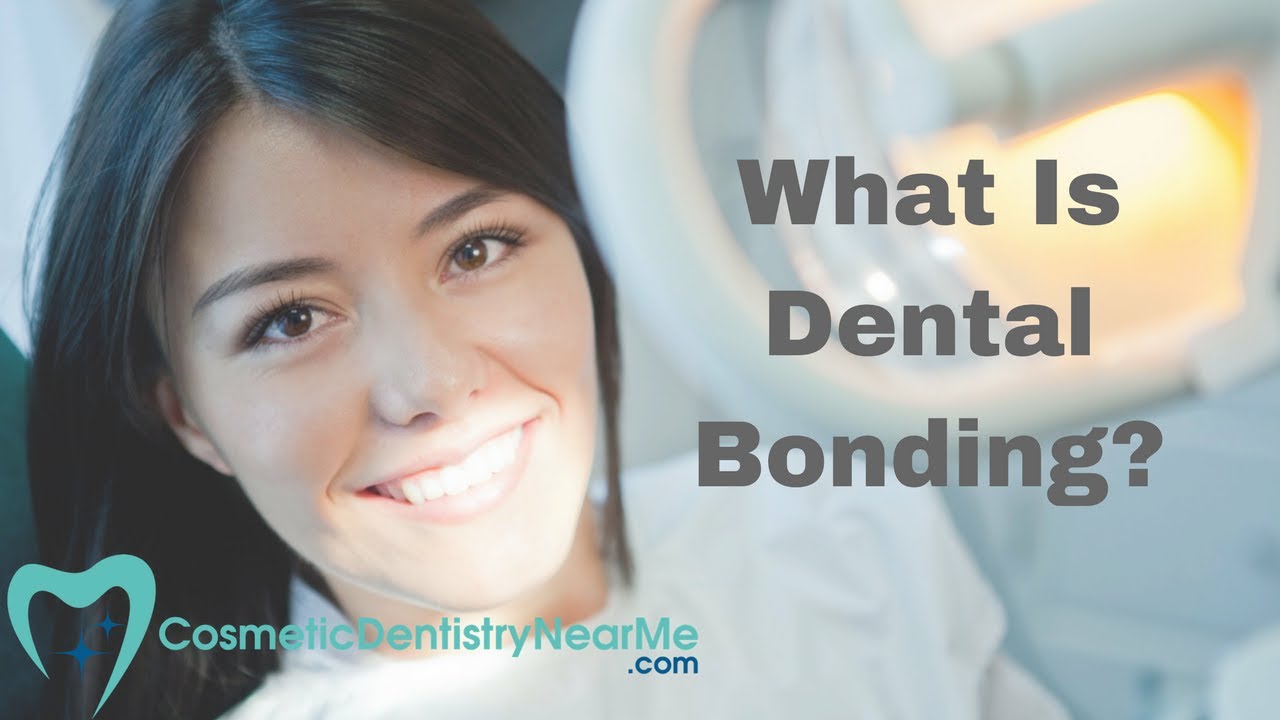 What is dental bonding? YouTube